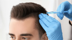 ACell PRP Therapy Hair Loss in Dubai