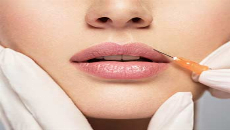 Botox Lip Flip In Dubai